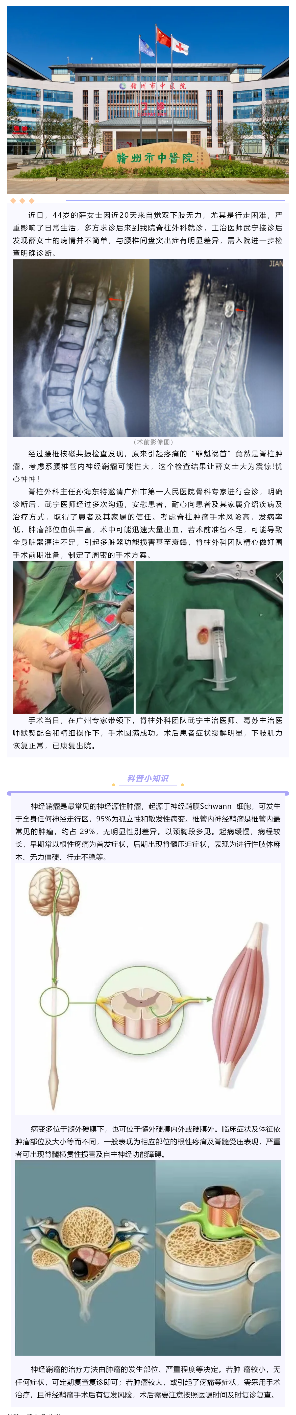 腰腿痛、下肢乏力麻木，提防神經(jīng)鞘瘤！.png